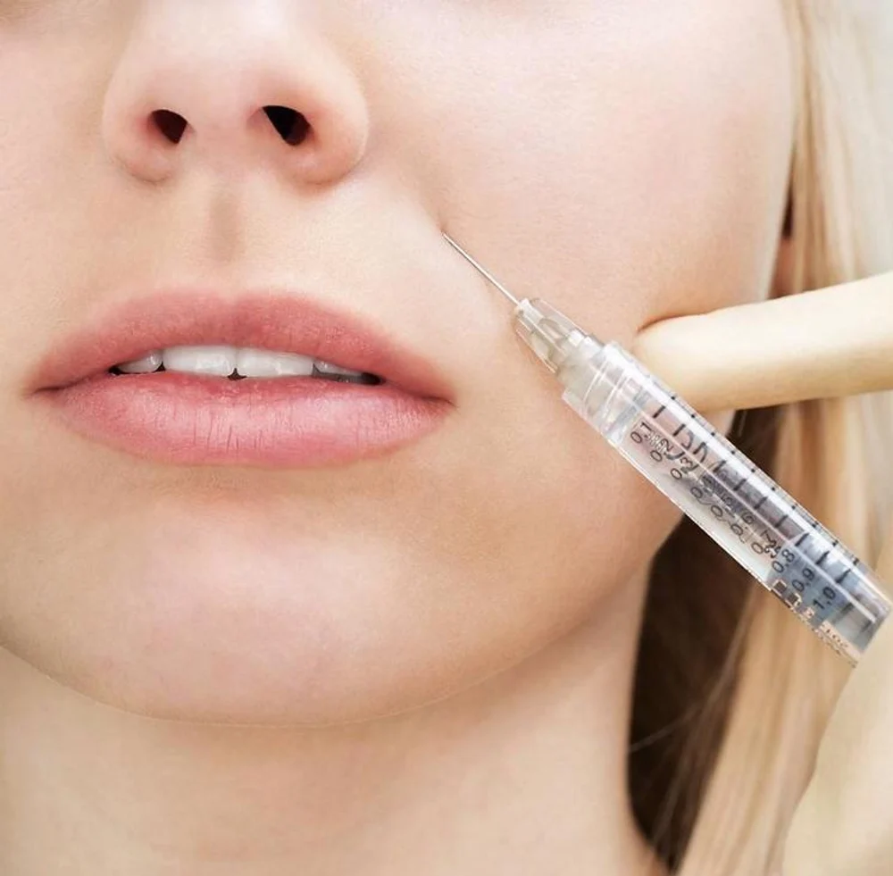 Контурная пластика носогубных складок 