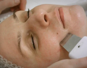 Ультразвуковая чистка лица