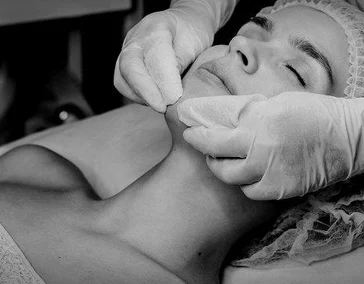 Коллагеностимуляция (CaHA)