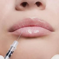 Контурная пластика губ